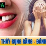Nằm mơ thấy rụng răng